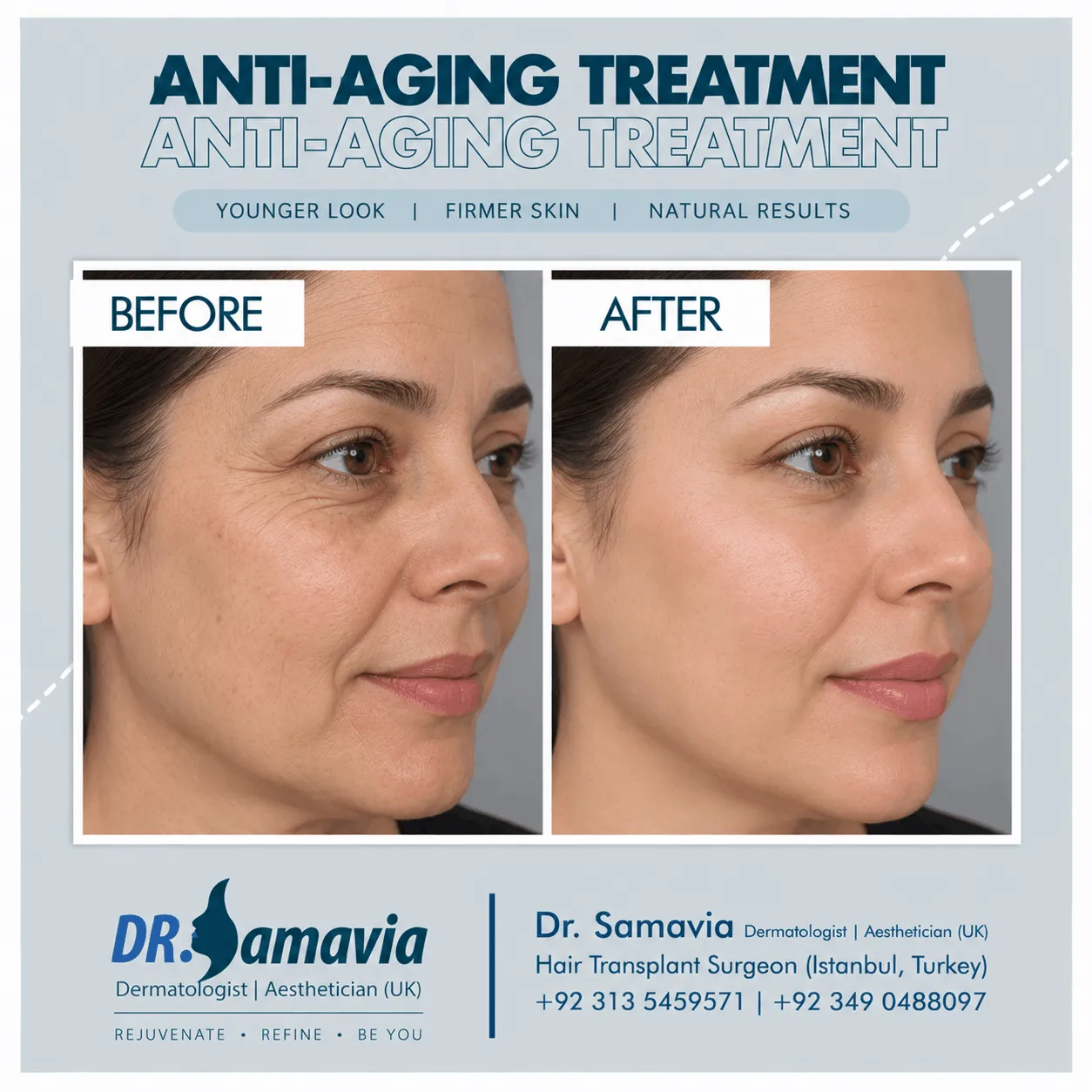 Anti-Aging Treatment