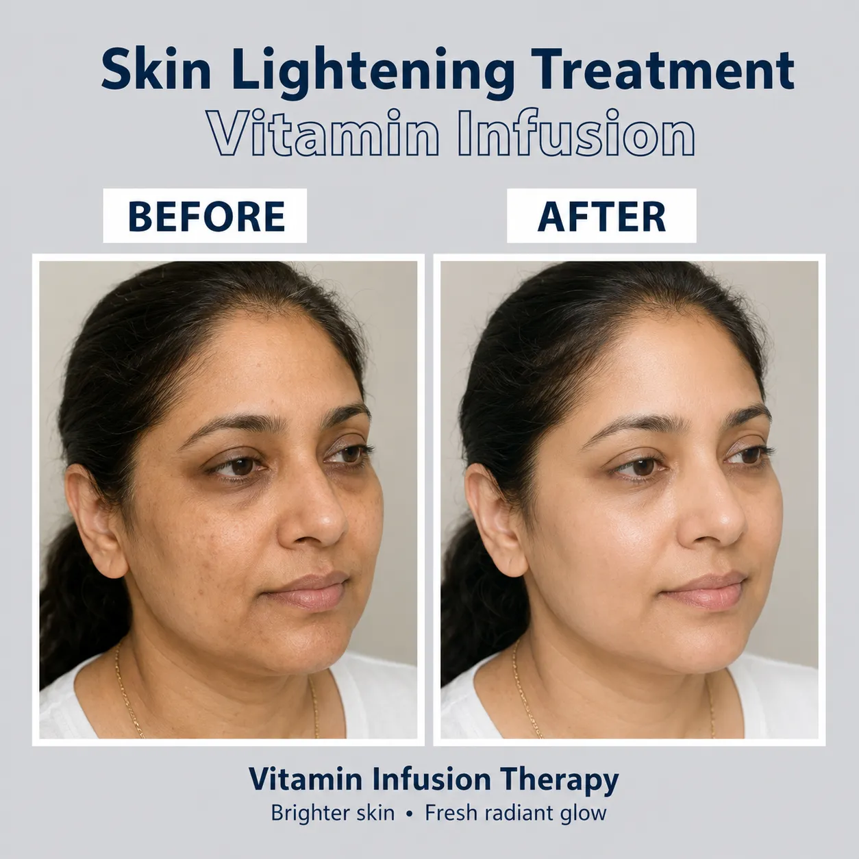 Skin Lightening Treatment Vitamin Infusion