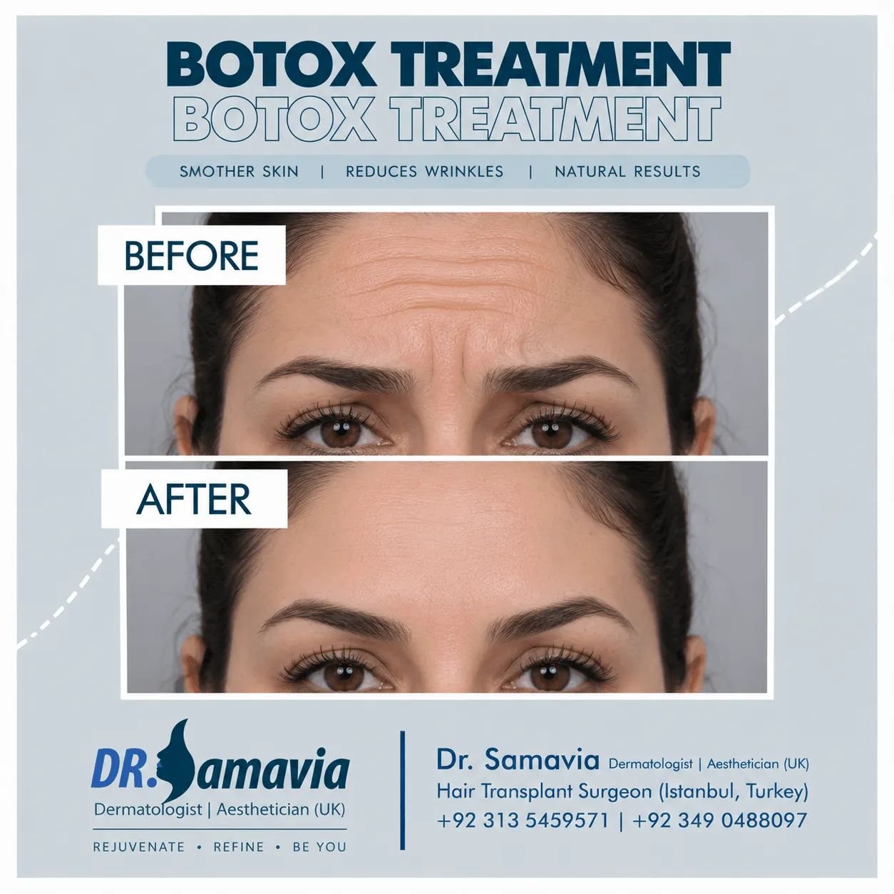 Botox & Fillers consultation at Dr Samavia Clinic Islamabad