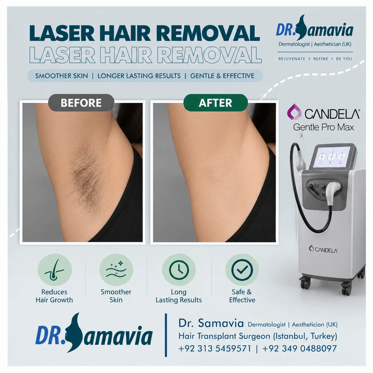 Laser Treatments consultation at Dr Samavia Clinic Islamabad