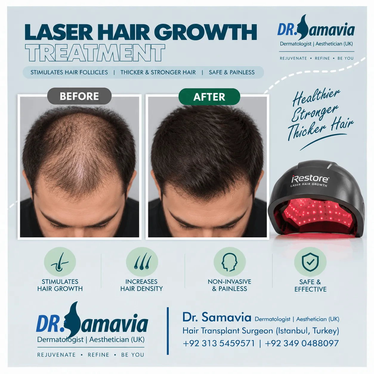 Laser Hair Growth Treatment
