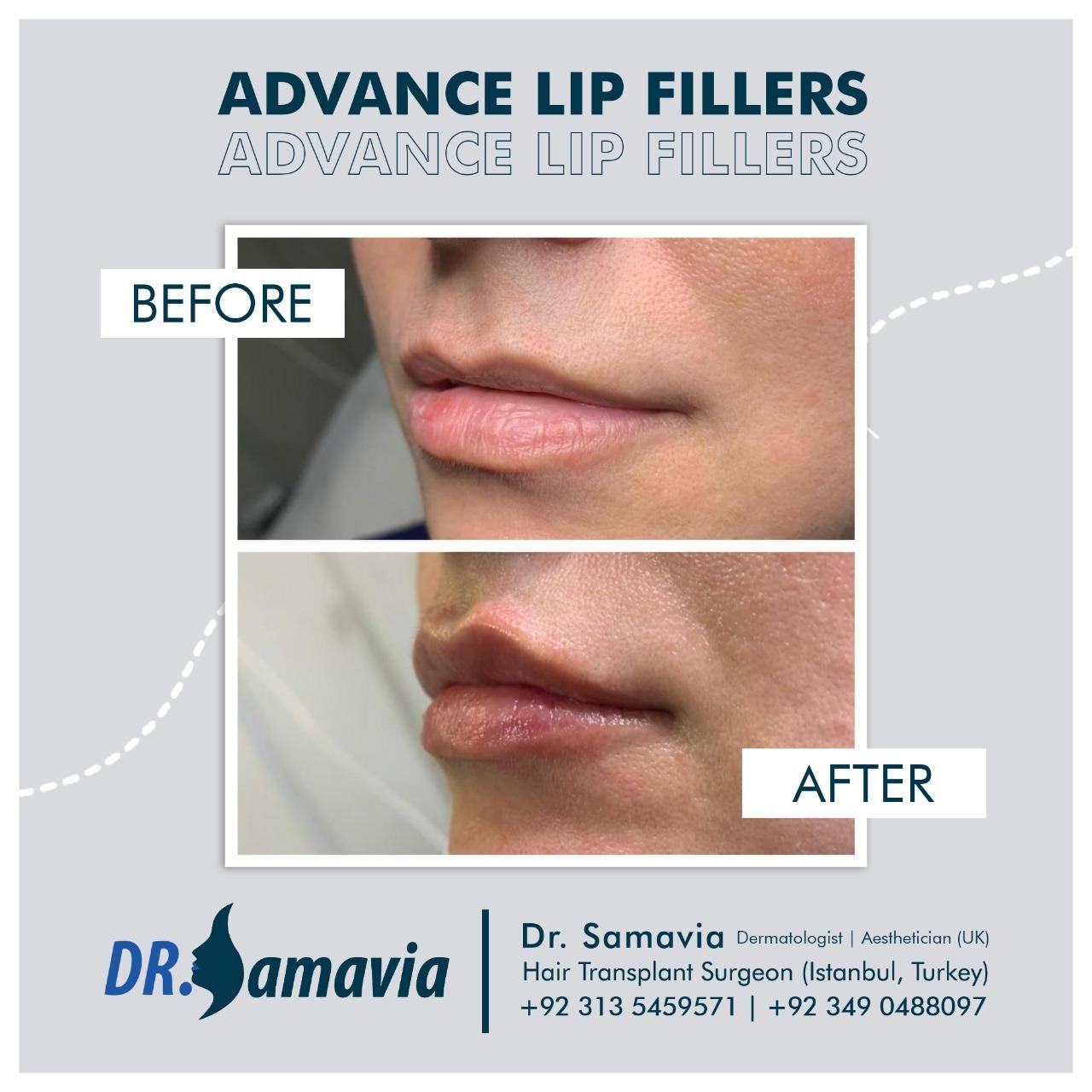 Before and after treatment result 7
