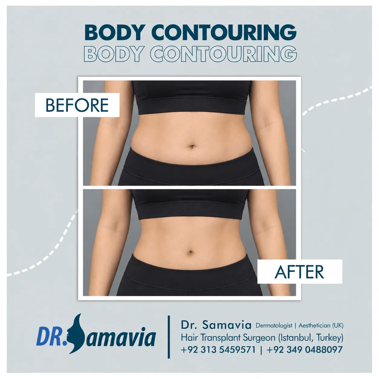 Body Contouring